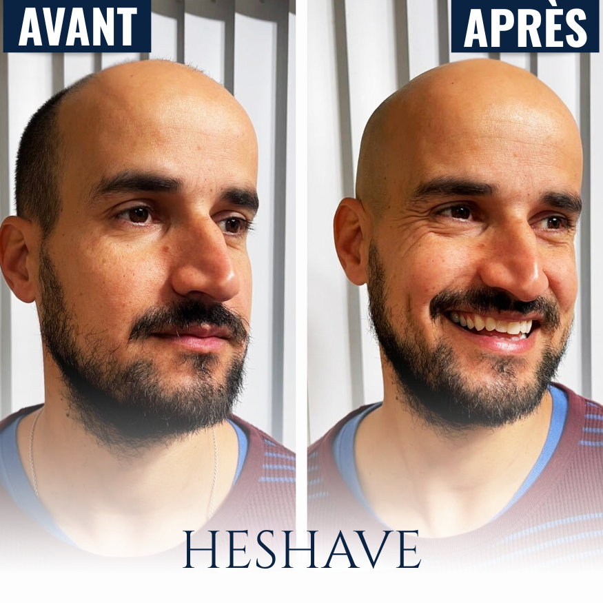 HeShave Pro™ – Kit Rasoir Crâne 5-en-1